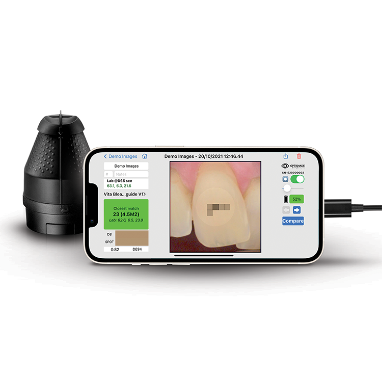Smile Line: Optishade Shade-Capturing Camera