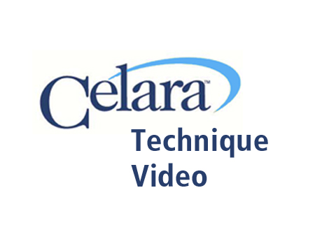 celara-video-thumbnail-copy.jpg